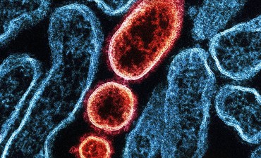 Nipah virus outbreak in West Bengal triggers regional alert